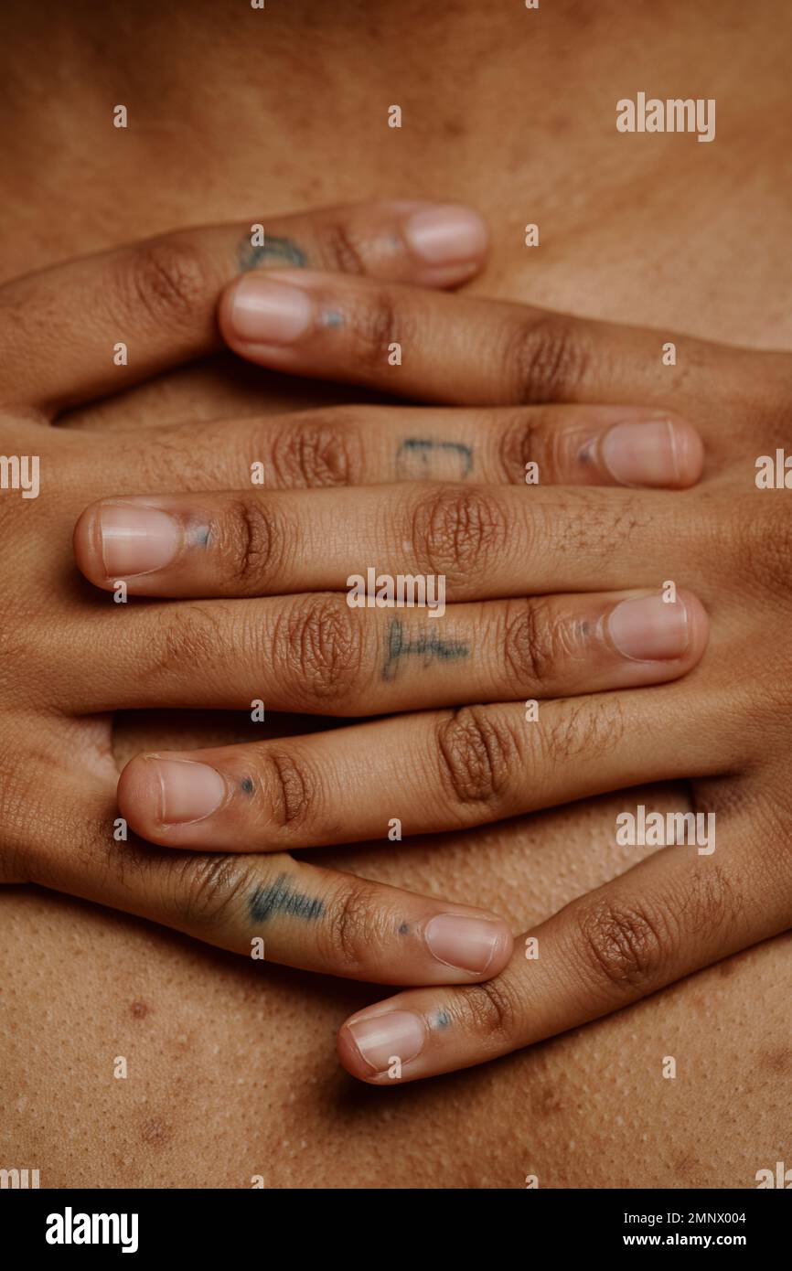 Nahaufnahme von gefalteten weiblichen Händen mit Fingertätowierungen über echter Hautstruktur mit Aknenarben Stockfoto