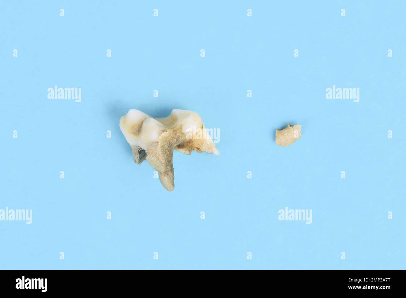Prämolarer Hundezahn mit Zahnstein und abgebrochenem Zahnsteinstück Stockfoto