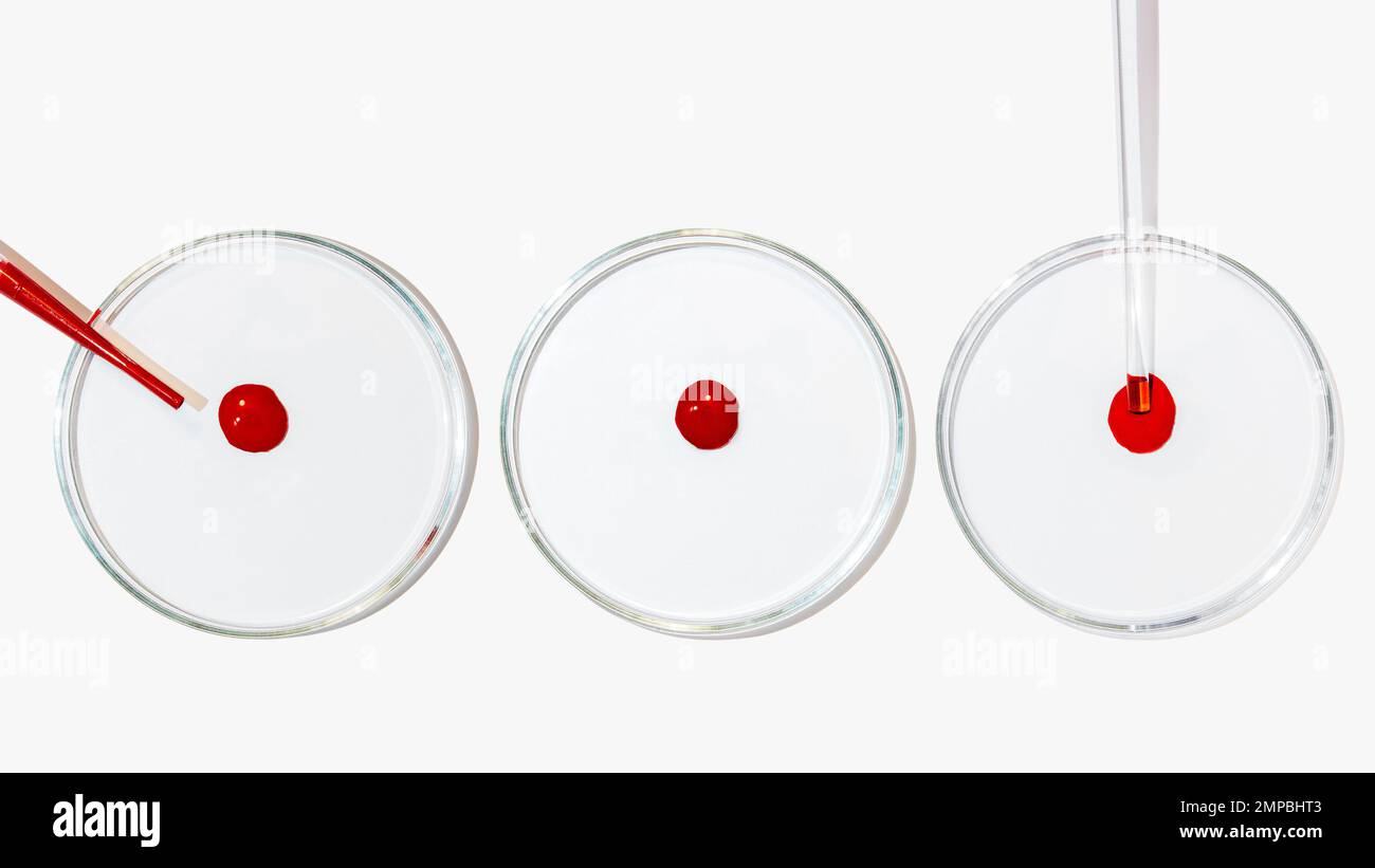 Mehrere Petrischalen auf hellem Hintergrund. Ein Tropfen Blut. Labortest, dna, Bluttest, Labor. Stockfoto