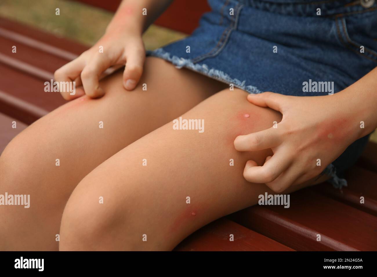 Scratching leg -Fotos und -Bildmaterial in hoher Auflösung – Alamy