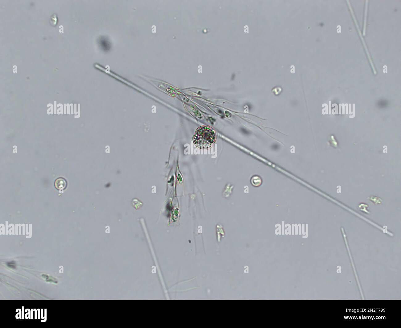 Kieselalgen, Algen unter mikroskopischer Sicht, Phytoplankton, Fossilien, Kieselsäure, goldgelbe Algen Stockfoto