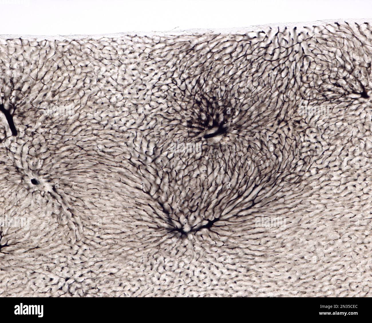 Die Untersuchung eines Organmikrogefäßes beinhaltet in der Regel das Füllen von Blutgefäßen mit einem unter dem Mikroskop sichtbaren Etikett. Lichtmikroskopie von Liv Stockfoto