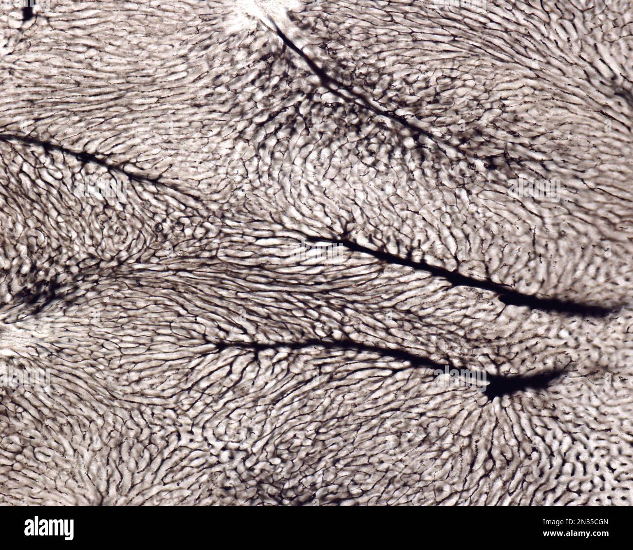 Die Untersuchung eines Organmikrogefäßes beinhaltet in der Regel das Füllen von Blutgefäßen mit einem unter dem Mikroskop sichtbaren Etikett. Lichtmikroskopie von Liv Stockfoto