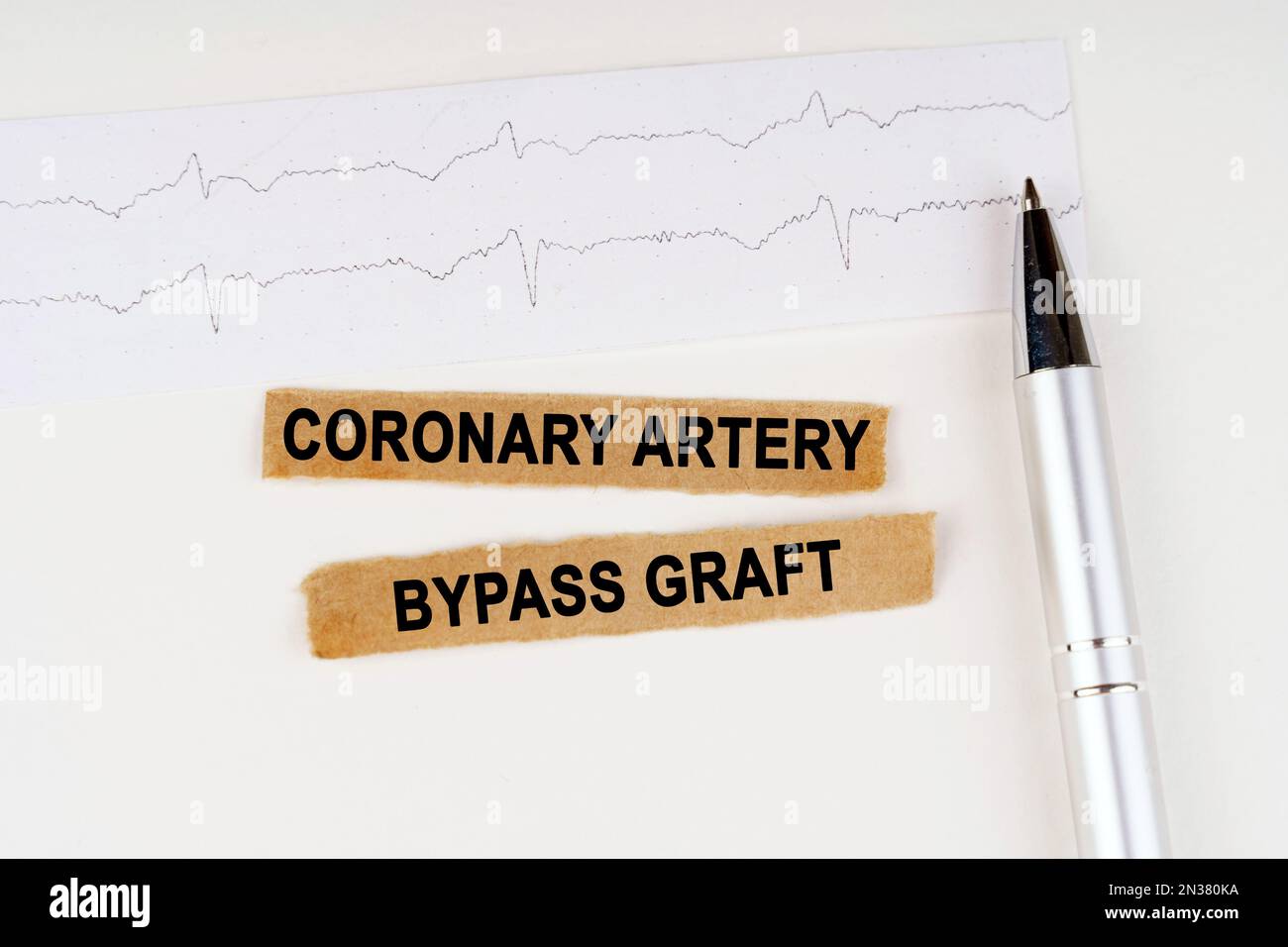 Medizinisches Konzept. Auf dem EKG liegt ein Stift und zerrissenes Papier mit dem Text - Koronararterien-Bypass-Transplantat Stockfoto