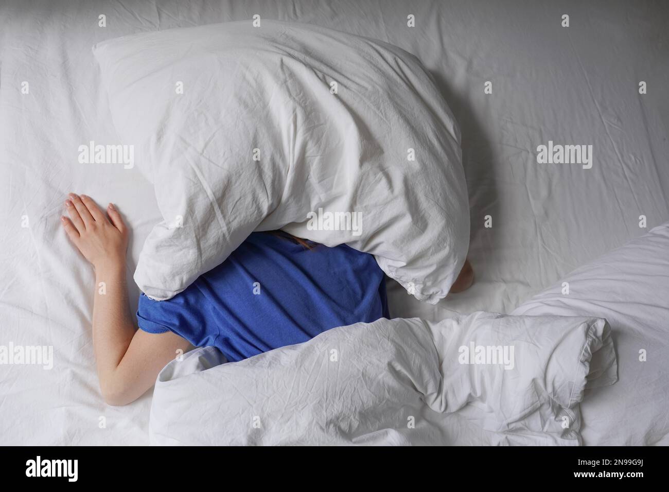 Eine unbekannte Frau, die im Bett schläft, mit einem Kopfkissen, um das Sonnenlicht auszublenden Stockfoto