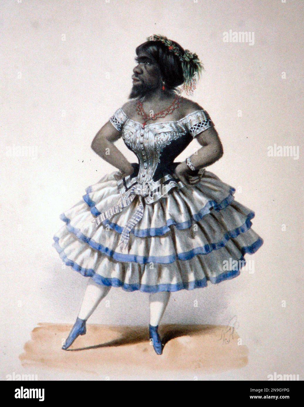 Julia Pastrana (1834-1860), Künstlerin und Sängerin im 19. Jahrhundert, die Hypertrichose hatte. Stockfoto