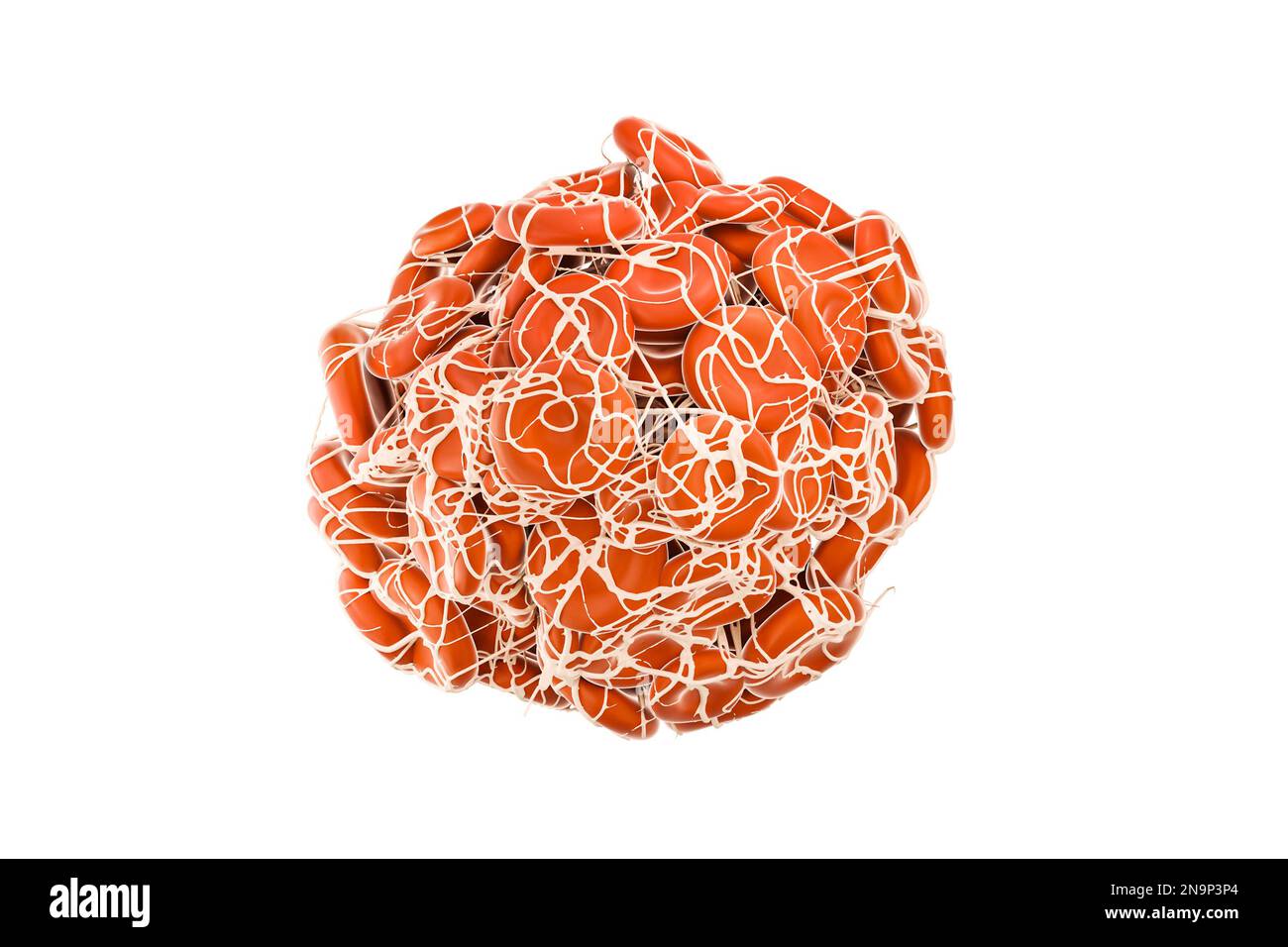 Blutgerinnsel oder Thrombus mit isoliertem Fibrin auf weißem Hintergrund 3D-Darstellung. Herz-Kreislauf-Erkrankungen, Medizin, Biologie, Wissenschaft, Healca Stockfoto