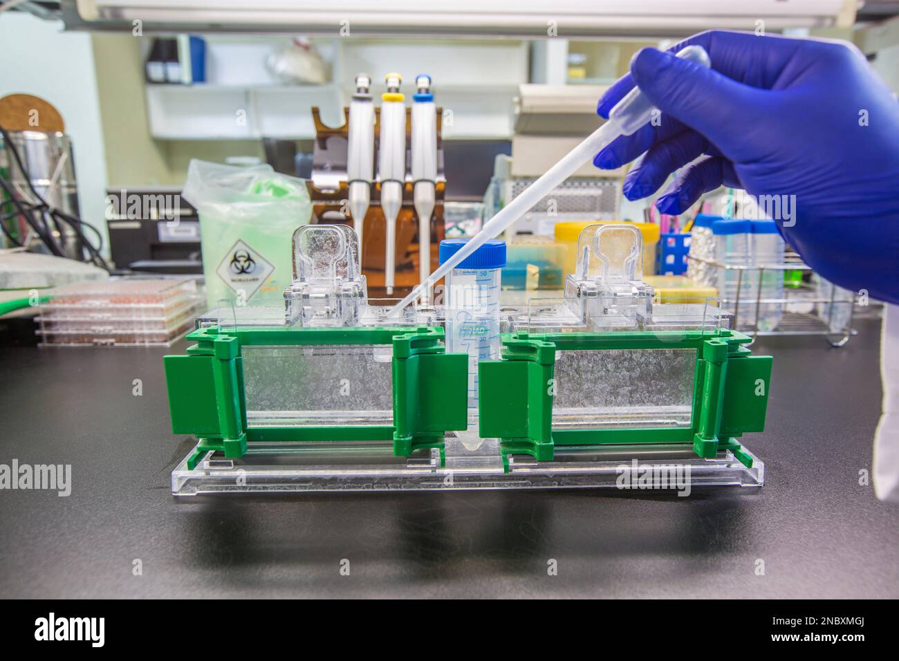 Die Western-Blot-Analyse als Proteinanalyse zum Proteinnachweis. Diese Technik wird in medizinischen oder Forschungslabors verwendet. Außerdem erkennt die Methode HIV Stockfoto