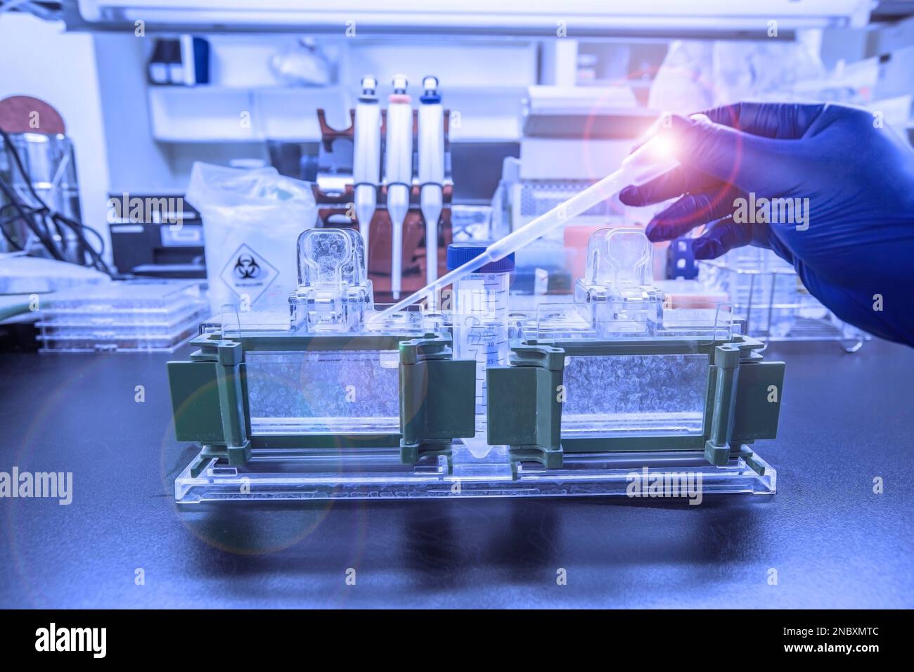 Die Western-Blot-Analyse als Proteinanalyse zum Proteinnachweis. Diese Technik wird in medizinischen oder Forschungslabors verwendet. Außerdem erkennt die Methode HIV Stockfoto