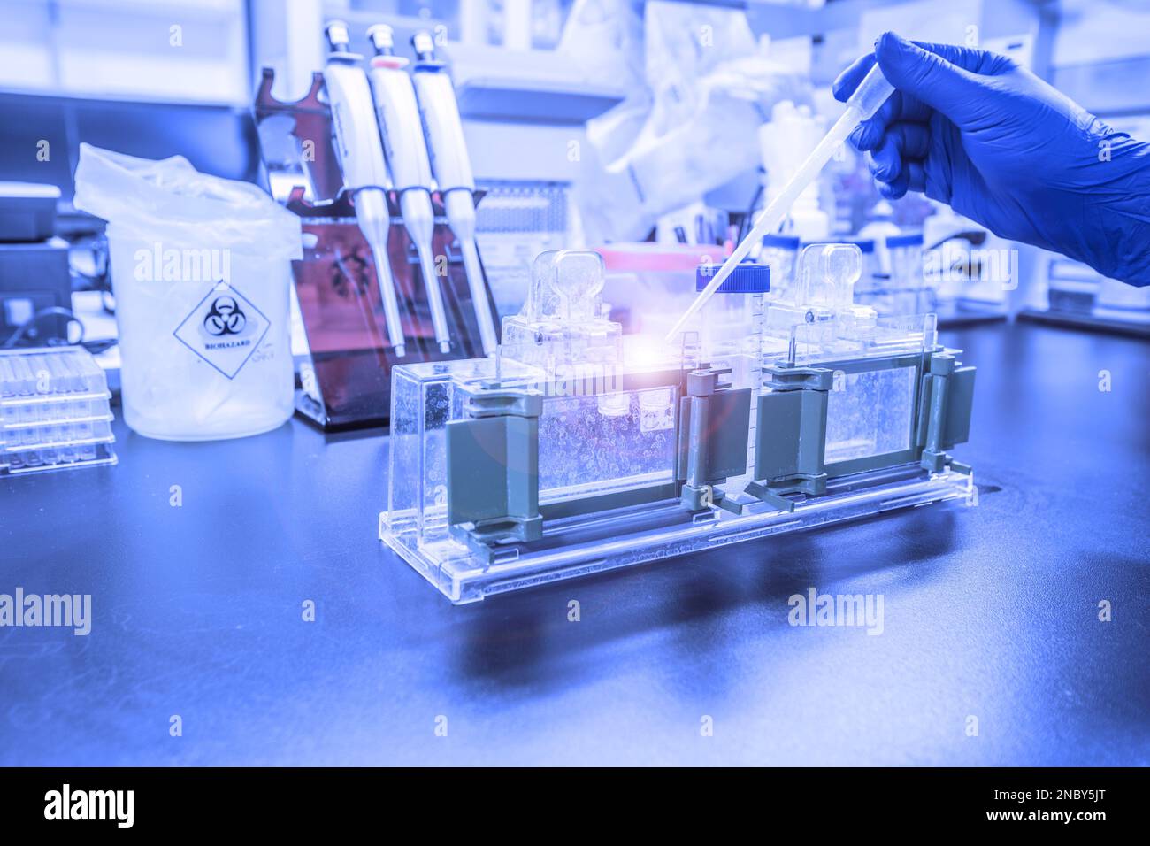 Die Western-Blot-Analyse als Proteinanalyse zum Proteinnachweis. Diese Technik wird in medizinischen oder Forschungslabors verwendet. Außerdem erkennt die Methode HIV Stockfoto