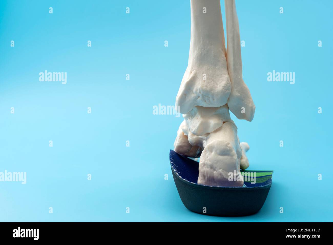 Anatomisches Modell der Knochen des Fußes mit orthopädischer Einlegesohle mit Copy Space Konzept für Fussgesundheitslösungen, Knöchelschmerzbehandlung ME Stockfoto