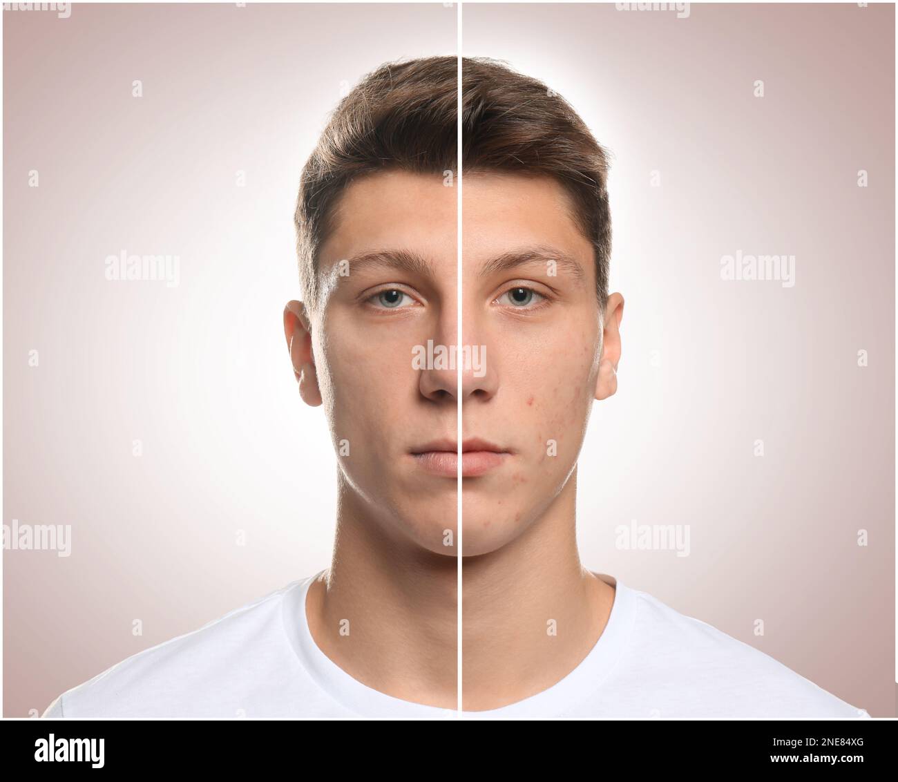 Hässlicher teenager Ausgeschnittene Stockfotos und -bilder - Alamy