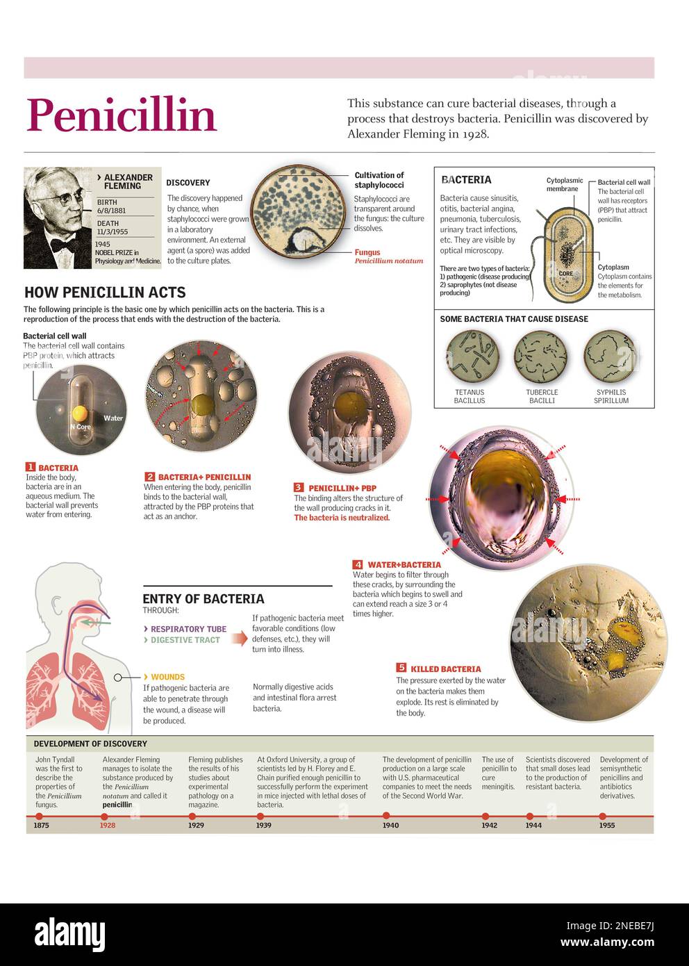 Infografiken des auf die Bakterien wirkenden Wirkstoffes des Penicillins und kurze Geschichte der Entdeckung des Penicillins. [Adobe Illustrator (.ai); 2480x3248]. Stockfoto