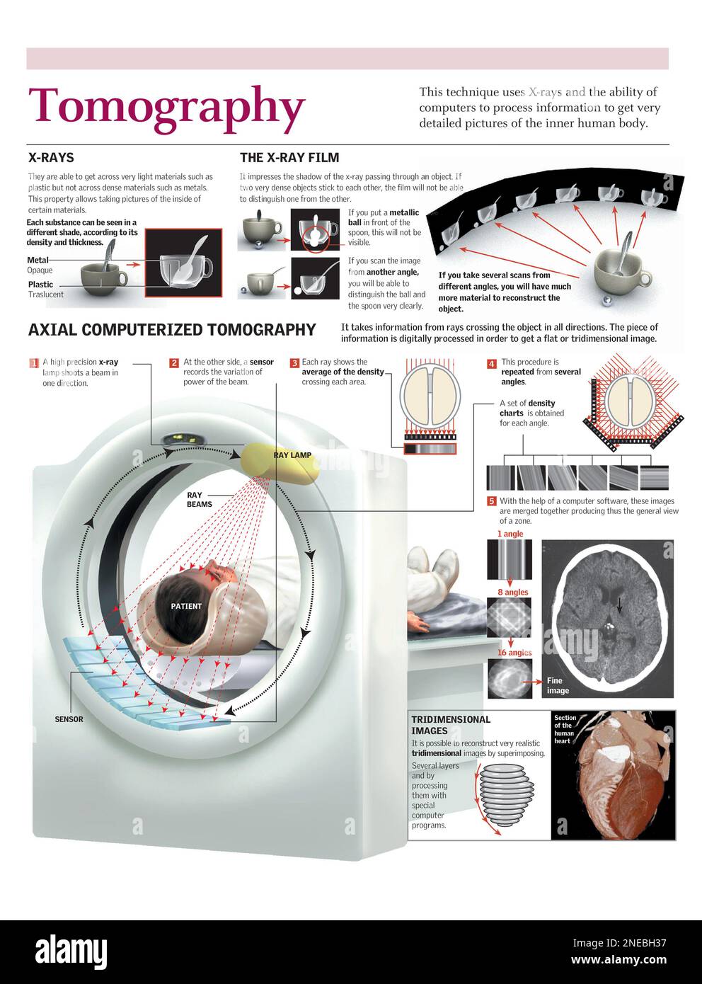 Infografiken zur Darstellung des menschlichen Körpers durch Computertomographie. [Adobe Illustrator (.ai); 2480x3248]. Stockfoto