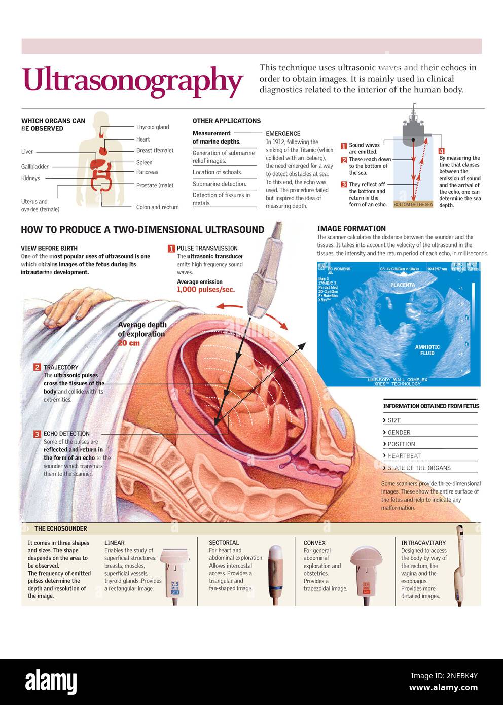 Infografiken zur Durchführung eines zweidimensionalen Ultraschallscans in der Schwangerschaft und andere Anwendungsmöglichkeiten von Ultraschalluntersuchungen. [Adobe Illustrator (.ai); 2480x3248]. Stockfoto