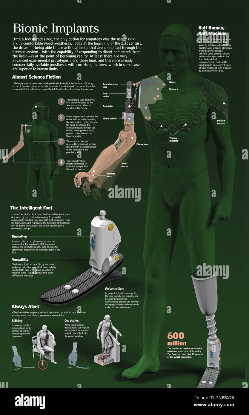 Infografik zur Funktionsweise künstlicher Arm- und Beinimplantate. [QuarkXPress (.qxp); 6259x4015]. Stockfoto