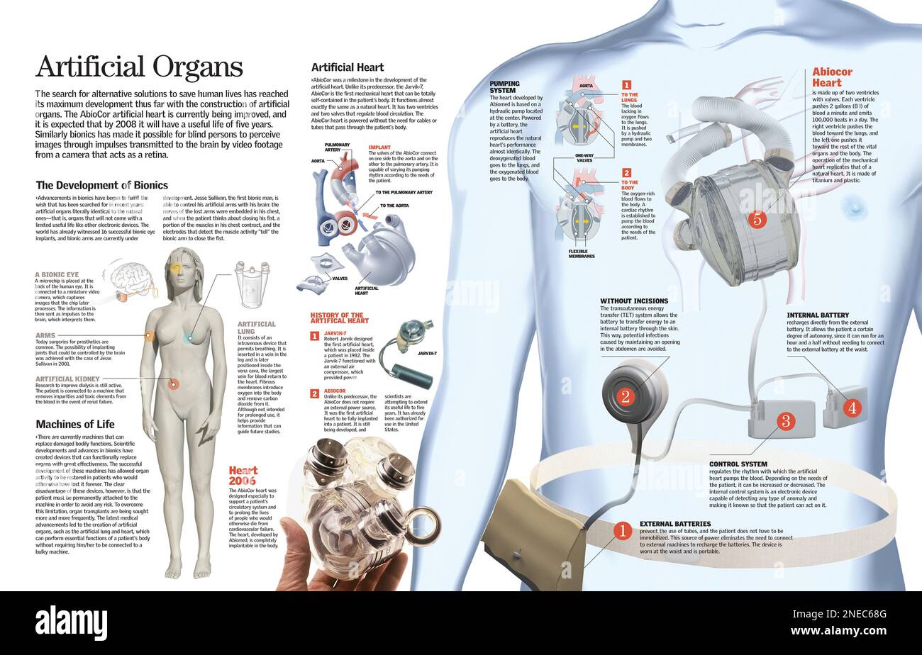 Infografik der wichtigsten künstlichen Organe zum Ersatz geschädigter Organe im Organismus: Künstliches Herz und bionische Implantate. [QuarkXPress (.qxp); 6259x4015]. Stockfoto