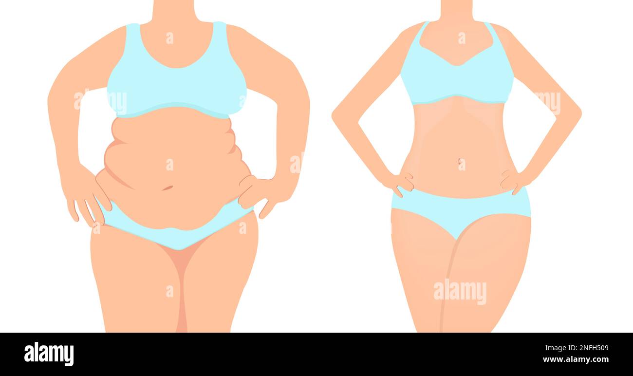 Vektor einer Frau vor und nach Gewichtsverlust durch Diät. Fett gegen schlanke Frau Stock Vektor