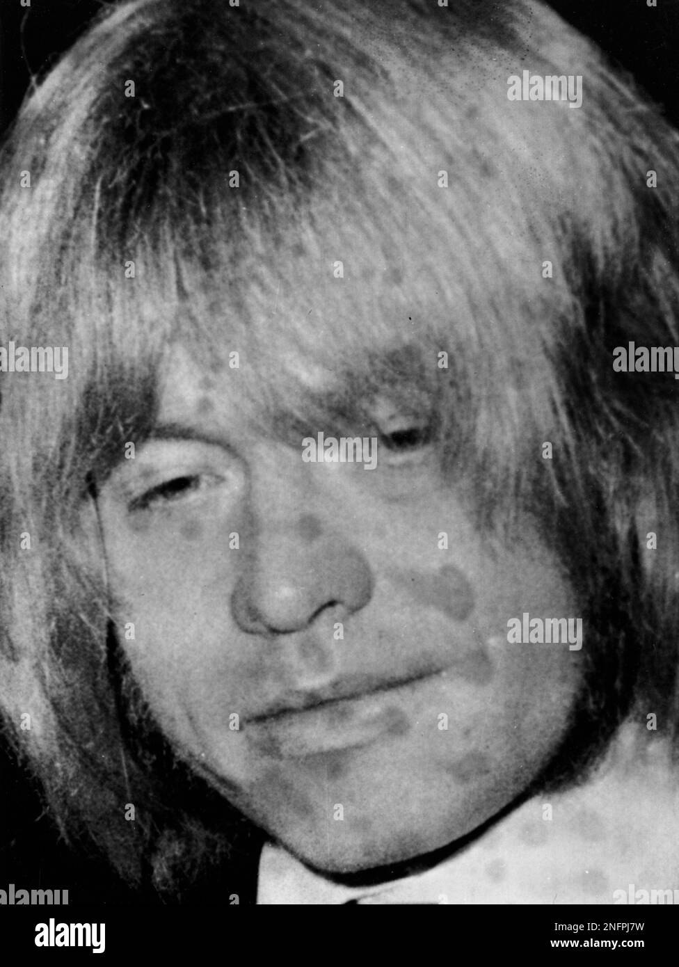 Portrait of Brian Jones, (February 28, 1942 - July 3, 1969), guitarist of  the Rock Band "The Rolling Stones", looks beat up with spots and marks on  his face as he appeared