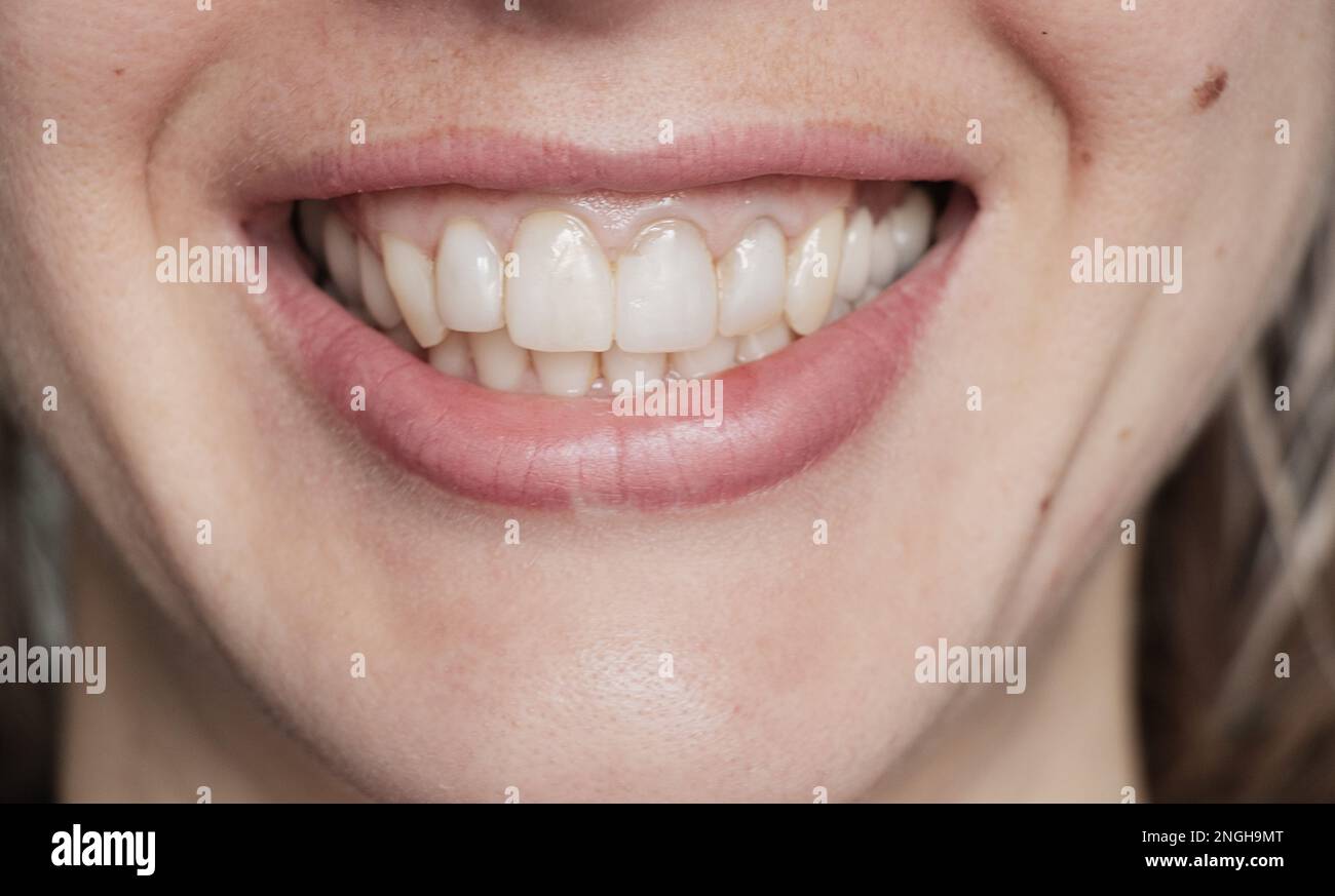 Weibliche Zähne in Nahaufnahme auf isoliertem Hintergrund Stockfoto