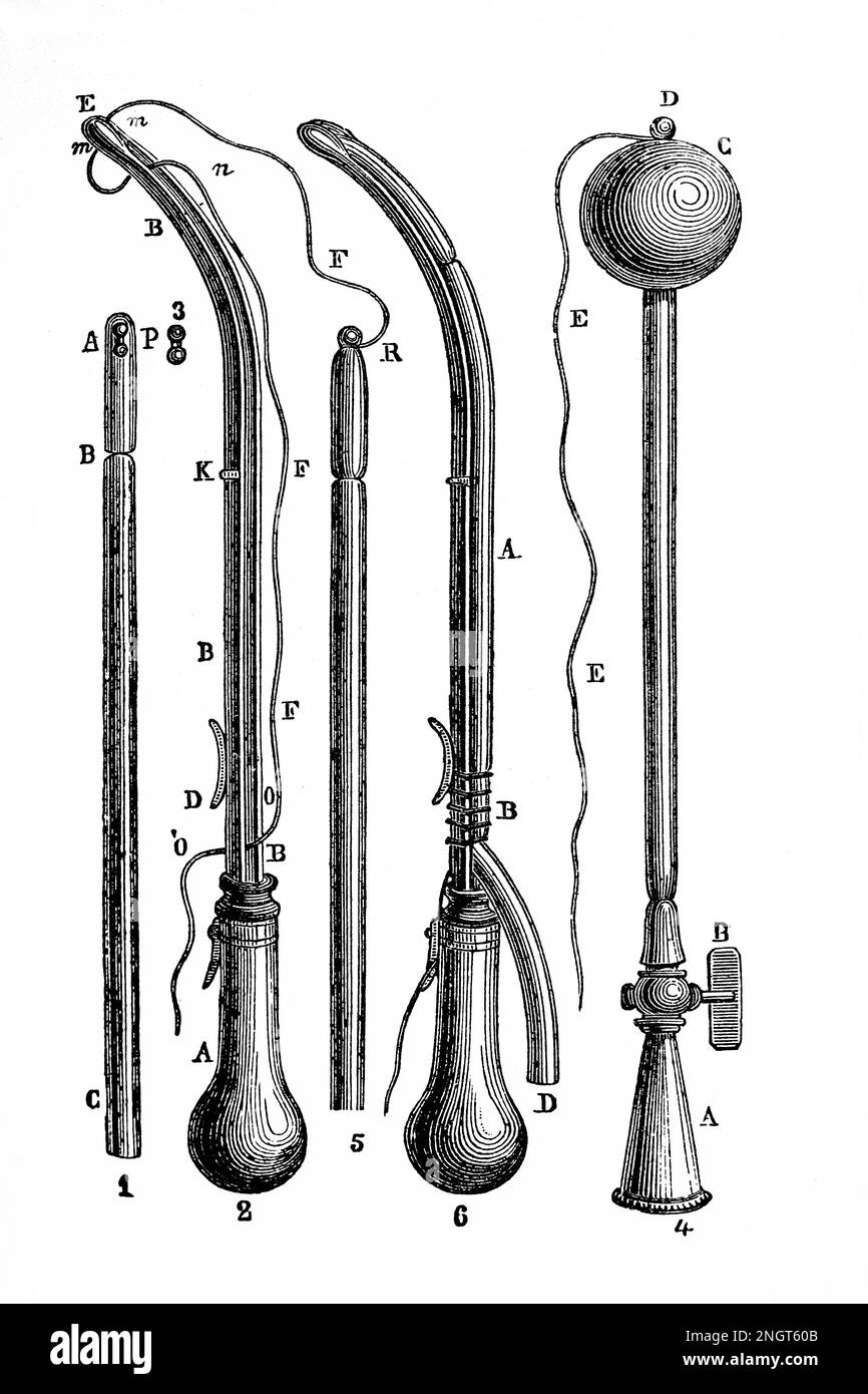 Der intrauterine Dilatator Tarnier mit seinem Zubehör. Antike Illustration aus einem Medizinbuch. 1889. Stockfoto