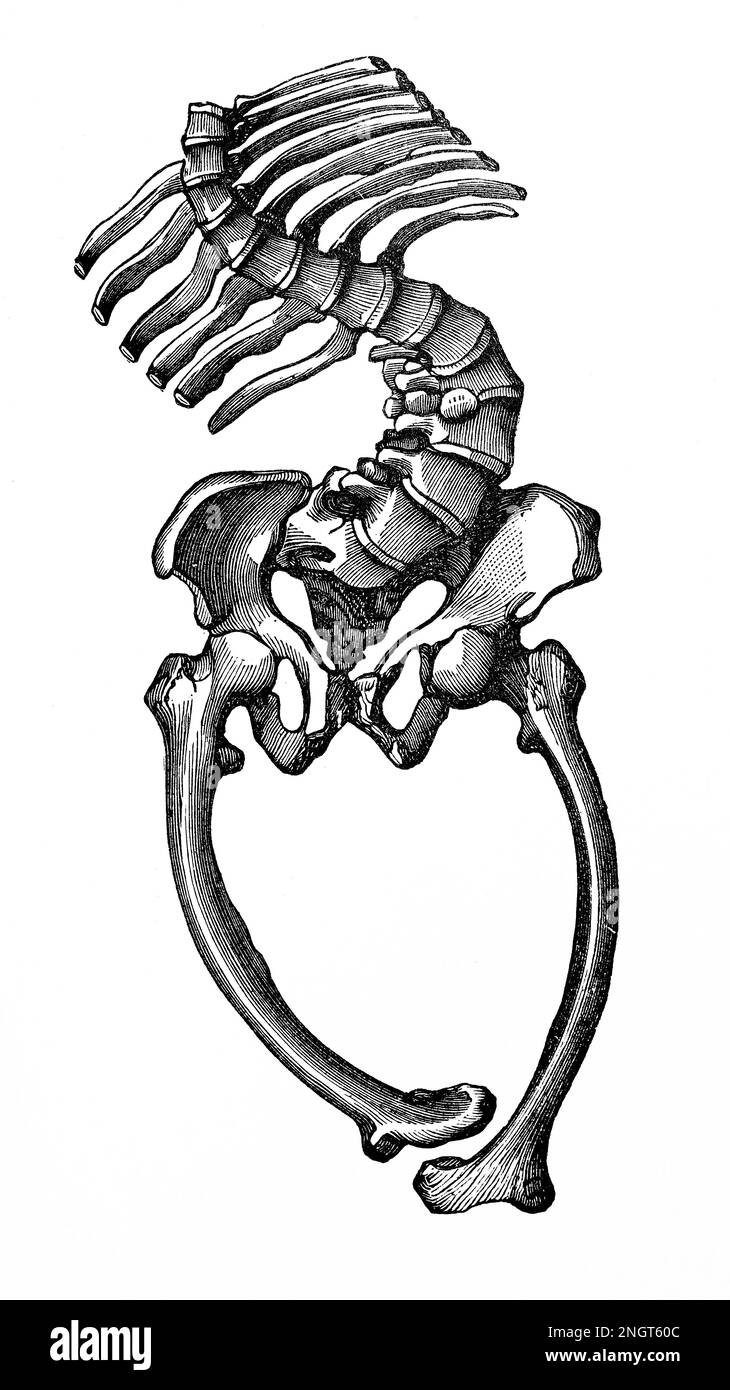 Wackeliges Skelett. Antike Illustration aus einem Medizinbuch. 1889. Stockfoto