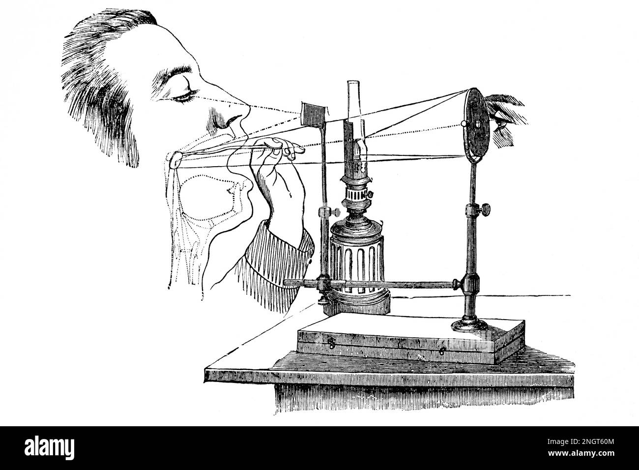 Laryngoskop. Instrument zur Kehlkopfuntersuchung. Antike Illustration aus einem Medizinbuch. 1889. Stockfoto