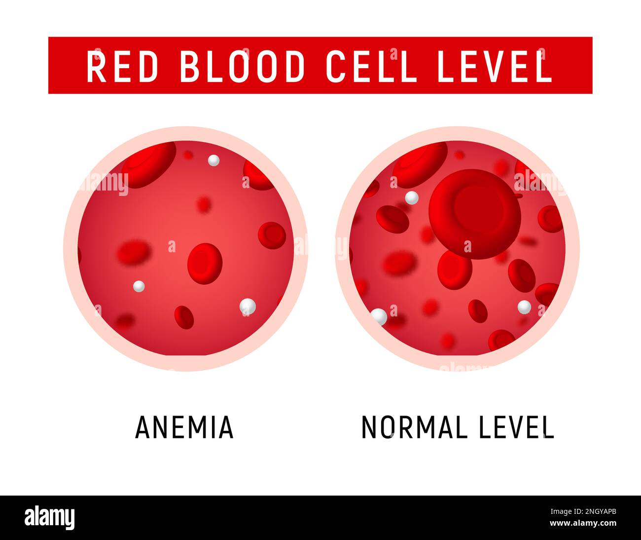 Anämie Problem Kreislauf Eisen Körper Diagramm Hintergrund. Anämiebiologie Blut isoliert medizinisch normal Symbol. Stock Vektor