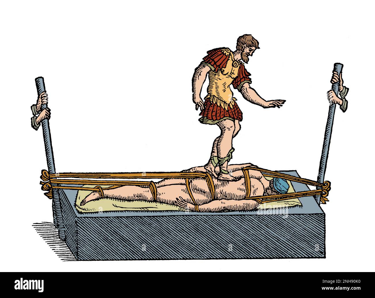 Galen-Methode zur Korrektur einer Wirbelsäulendeformität mit einem Gerät ähnlich dem Hippokratischen Brett, das Druck auf den Rücken ausübt. Opera Omnia, 1565. Galen (129 - ca. 216) war ein griechischer Arzt, Chirurg und Philosoph im Römischen Reich. Gefärbt. Stockfoto