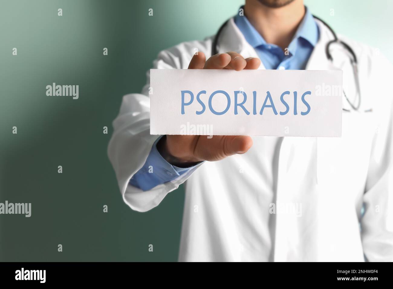 Arzt hält Schild mit Wort PSORIASIS auf farbigem Hintergrund, Nahaufnahme Stockfoto