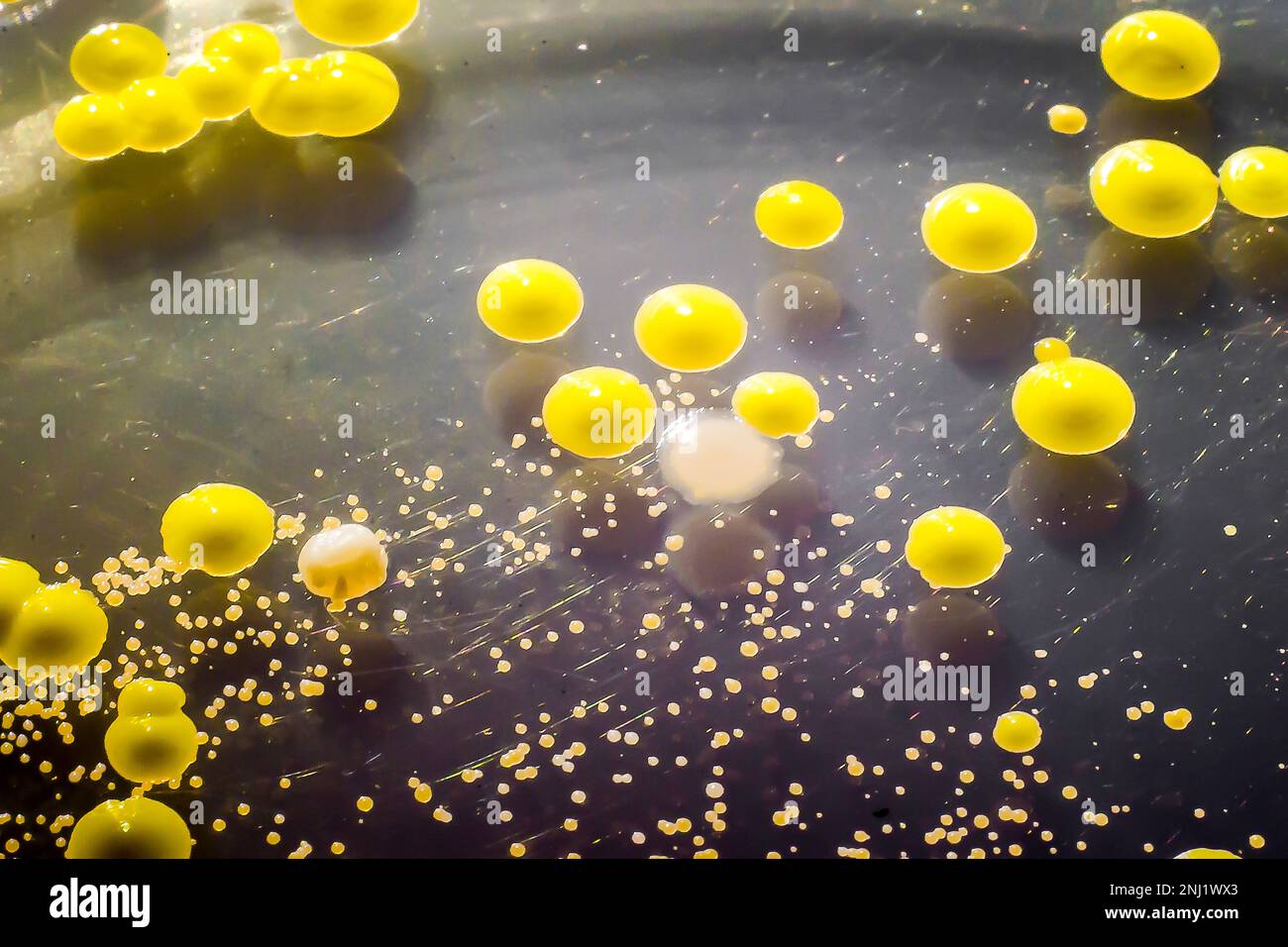 Bakterien aus einem Hautausstrich, Kolonien von Micrococcus luteus und