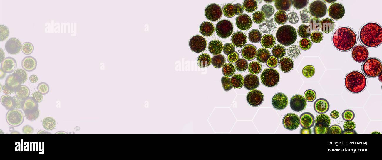 Haematococcus pluvialis Grün- und Zystenalgen unter mikroskopischer Sicht, leerer Raum - Hämatozyste, aktive und ruhende Zellen, starkes Antioxidans Astaxanth Stockfoto