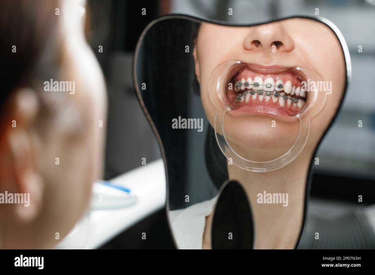 Eine junge Frau, die ihre Zahnspange ansieht und lächelt. Stockfoto