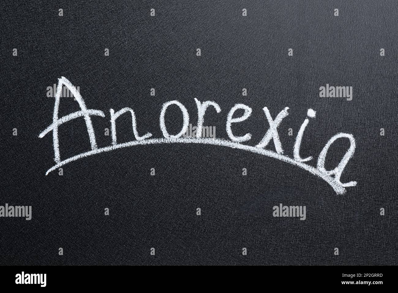 Das Wort Anorexia mit weißer Kreide an der Tafel Stockfoto