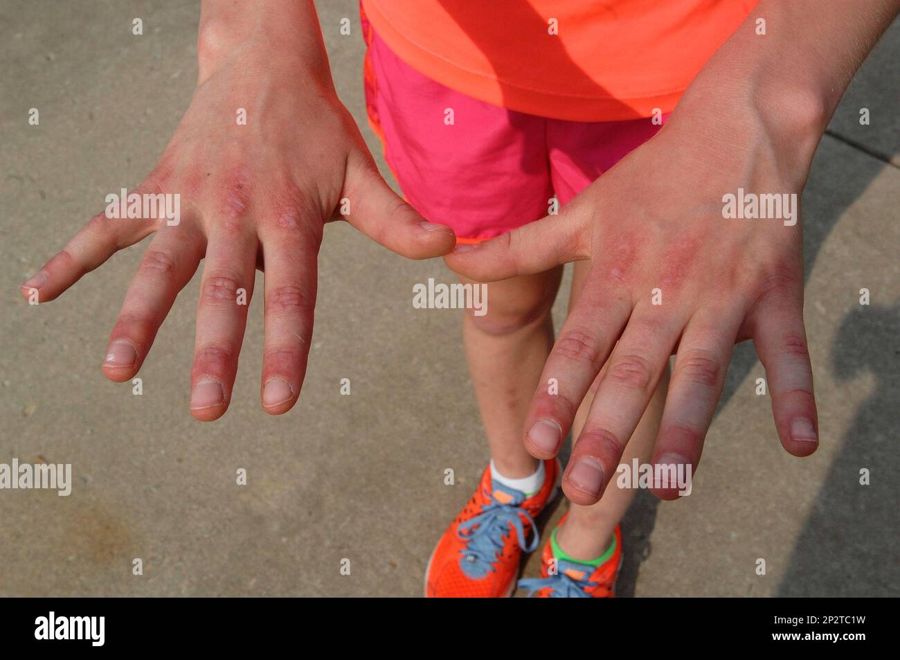 ADVANCE FOR USE SATURDAY, JUNE 20 AND THEREAFTER In this March 29