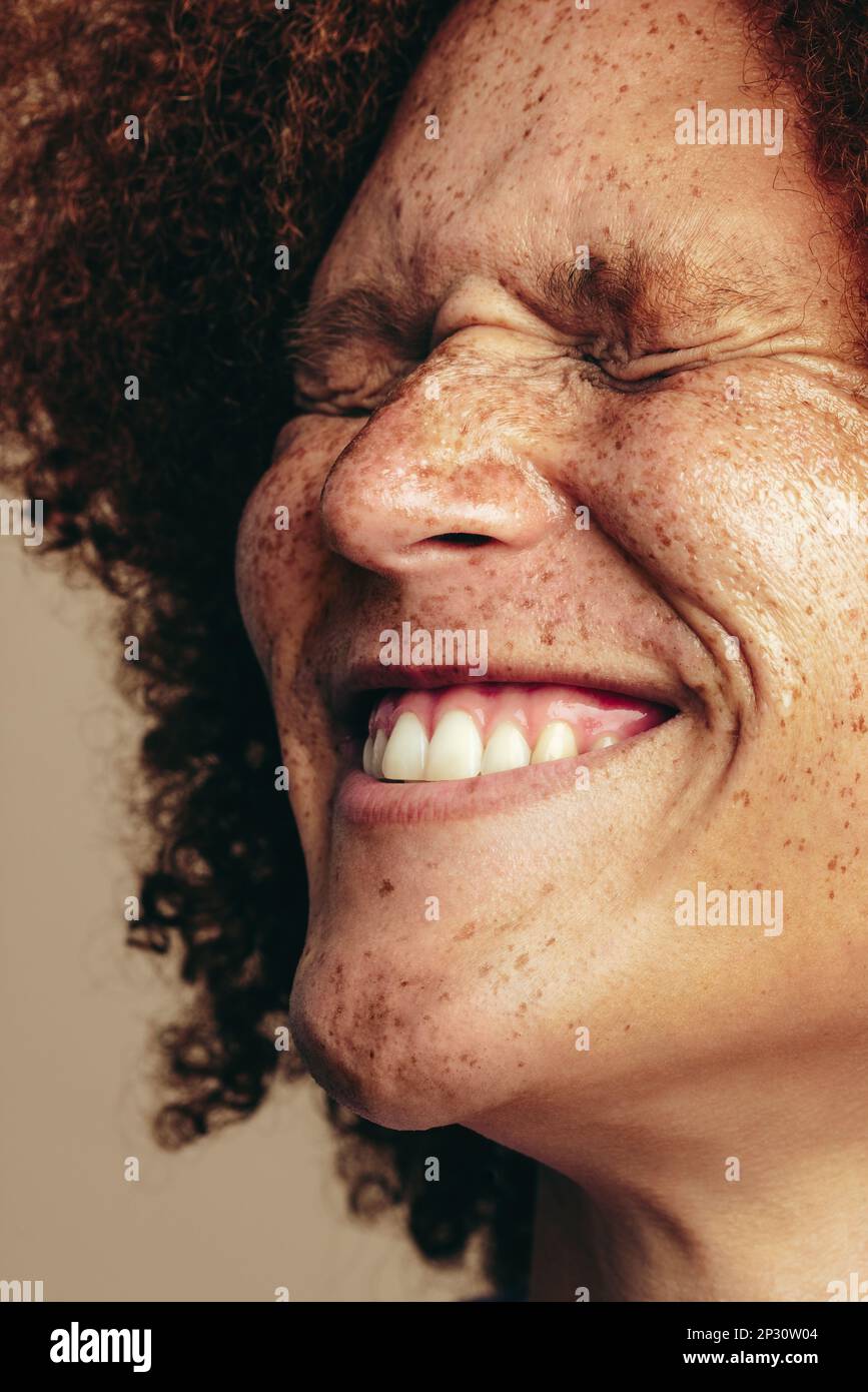 Junger Mann mit glühender Sommersprossen und Ingwerhaaren lächelt in einem Studio. Glücklicher und junger Mann, der seine einzigartigen Schönheitsmerkmale mit Selbstliebe feiert Stockfoto