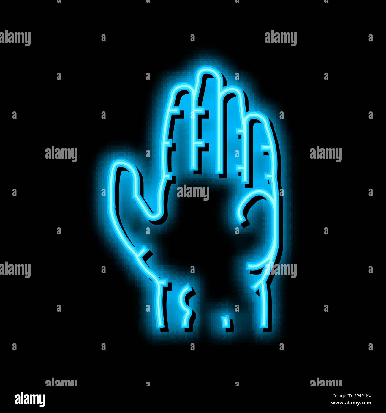 Sklerodermie Hautkrankheit Neonglühsymbol Illustration Stock Vektor