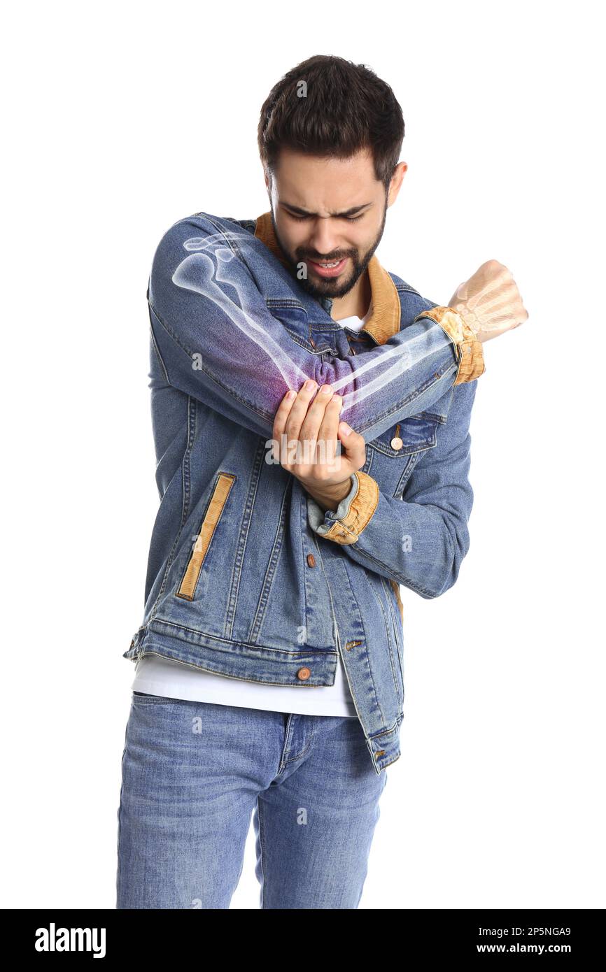 Mann mit Ellenbogenschmerzen auf weißem Hintergrund. Digitale Kompositationen mit Darstellung von Armknochen Stockfoto