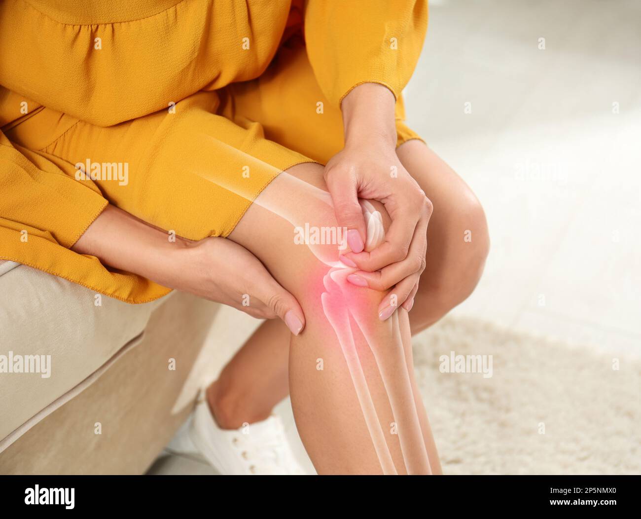 Kranke Frau zu Hause, Nahaufnahme. Digitale Komposition mit Darstellung des Kniegelenkes Stockfoto