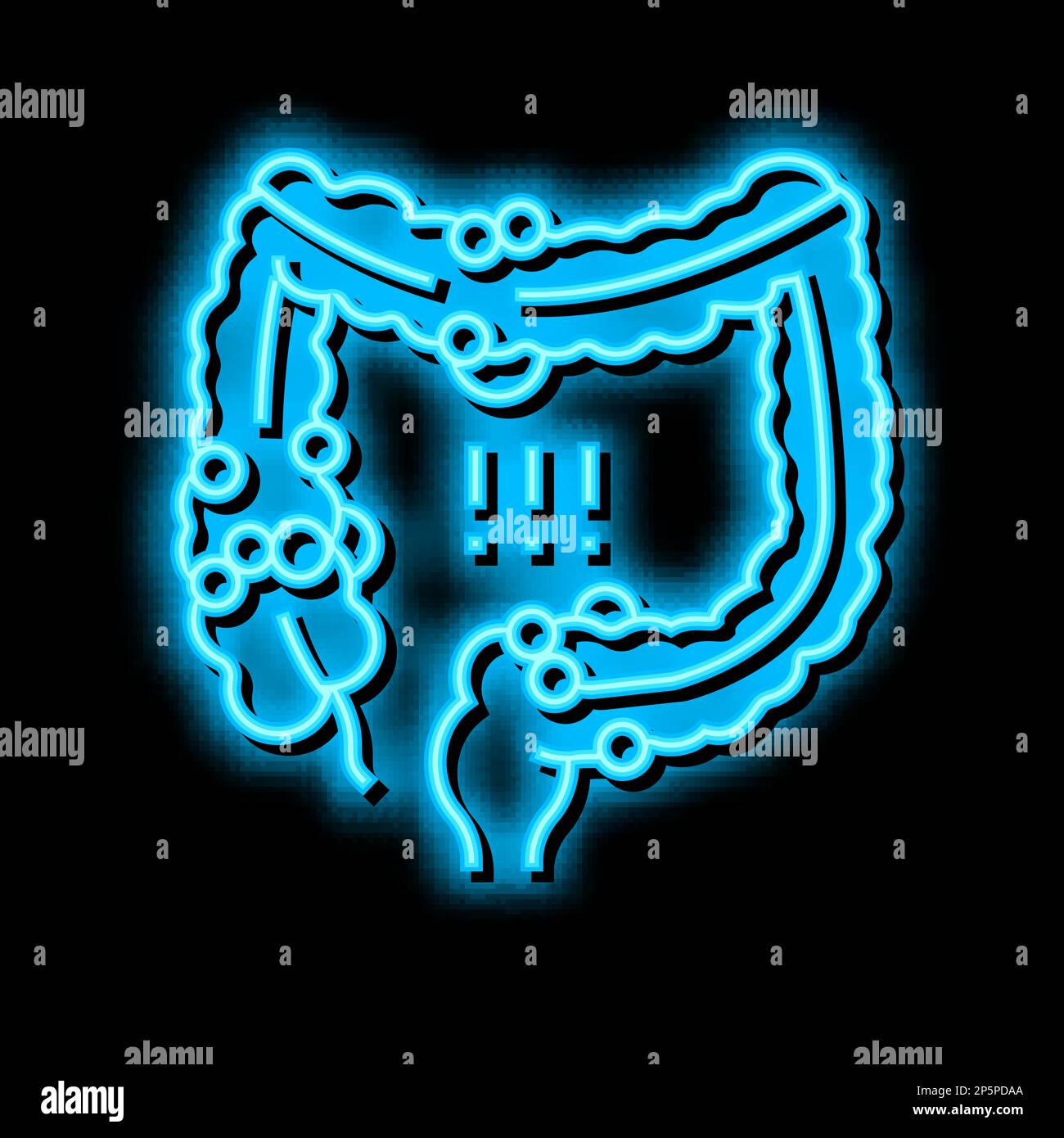 crohns-Krankheit Neon-Glow-Symbol Illustration Stock Vektor