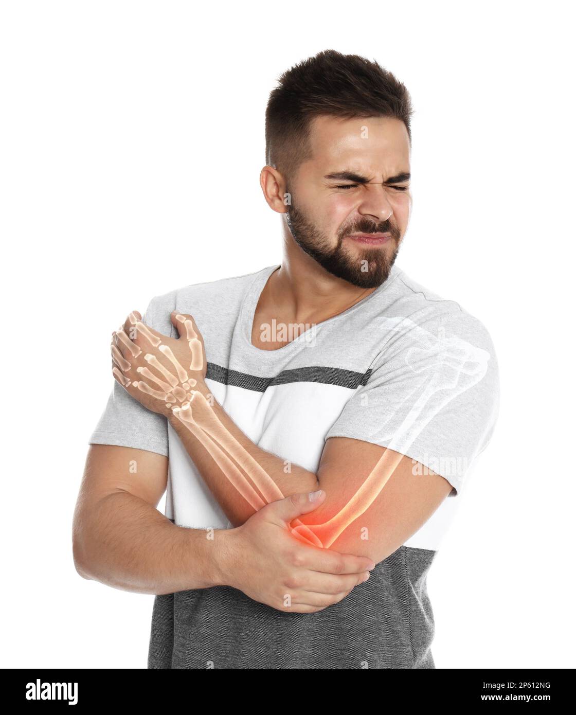 Mann mit Ellenbogenschmerzen auf weißem Hintergrund. Digitale Kompositationen mit Darstellung von Armknochen Stockfoto