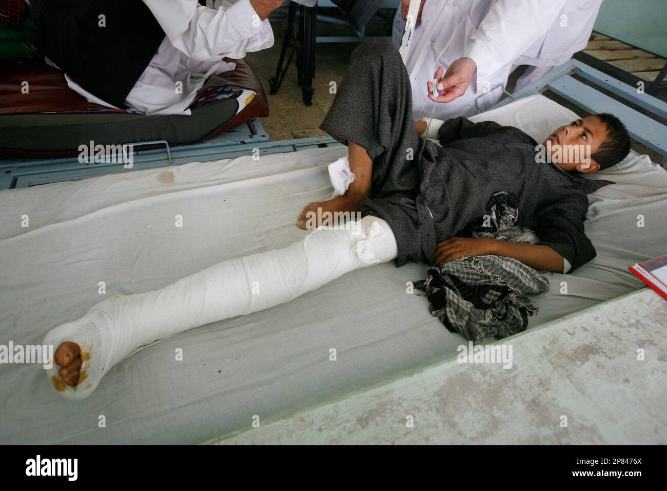 Shafiullah, 10, an Afghan boy, who was injured by Friday's NATO airstrike, lies on a bed at a hospital in Kunduz, Kunduz province, north of Kabul, Afghanistan, Saturday, Sept. 5, 2009. (AP Photo/Musadeq Sadeq) Stockfoto