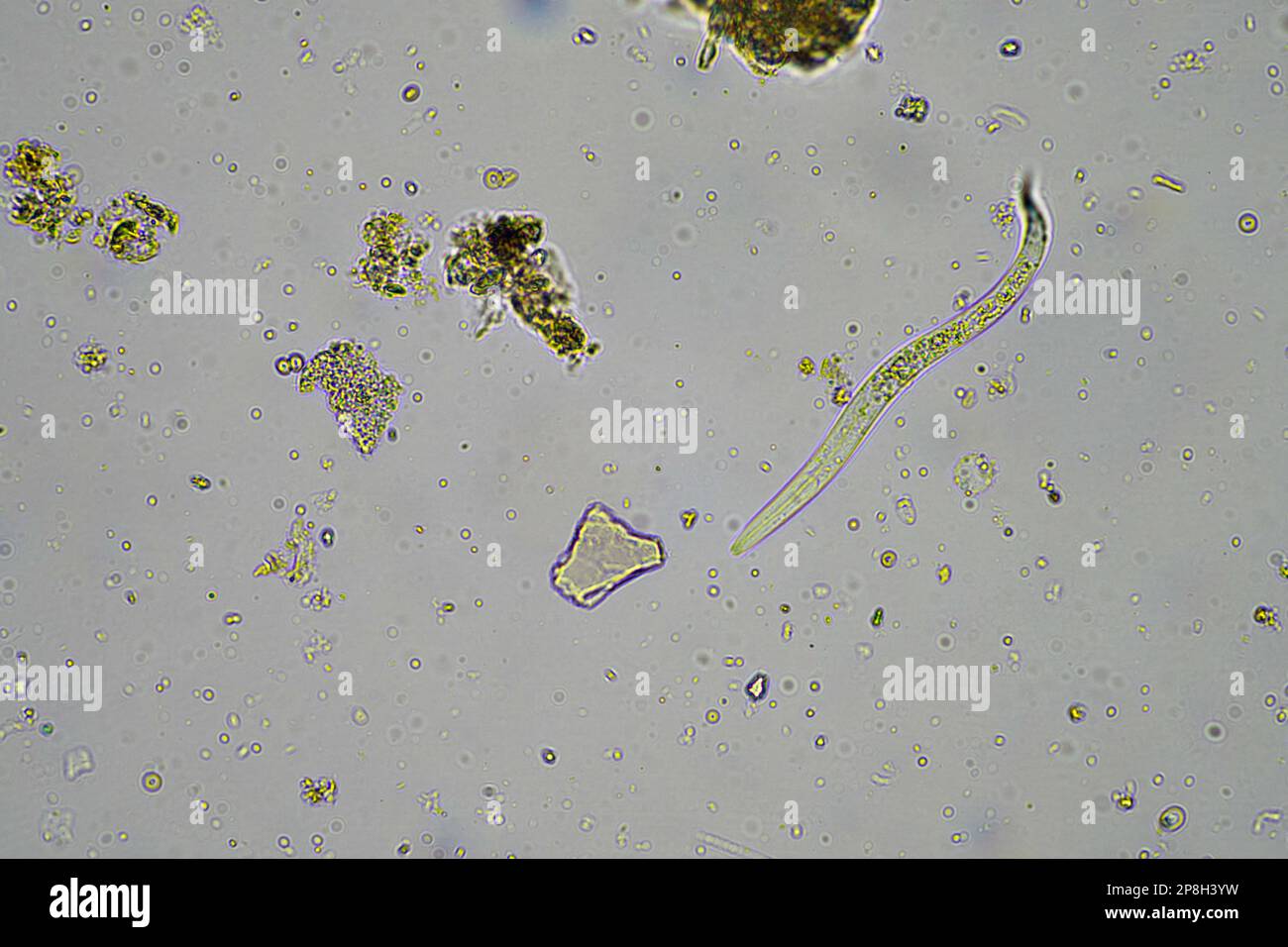 Bodenmikroorganismen wie Nematoden, Mikroarthropoden, Mikroarthropoden, Tardigrade und Rotoren eine Bodenprobe, Bodenpilze und Bakterien auf einem Regen Stockfoto