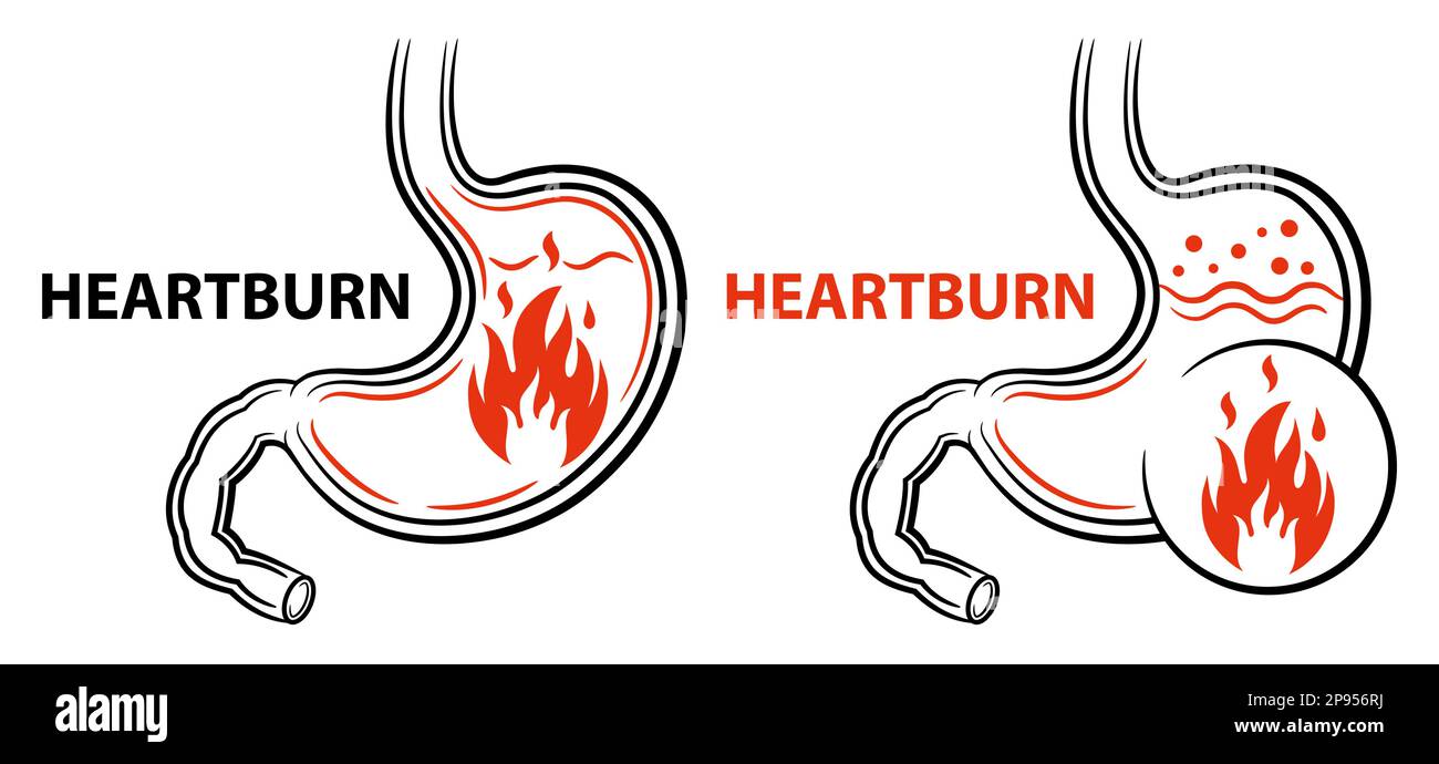 Sodbrennen, Magenbrennen Feuer Schmerzen, Gastritis, GERD saures Reflux Krankheit, Magengeschwür Symbol. Medikamentöse Behandlung des Verdauungssystems. Vektor Stock Vektor