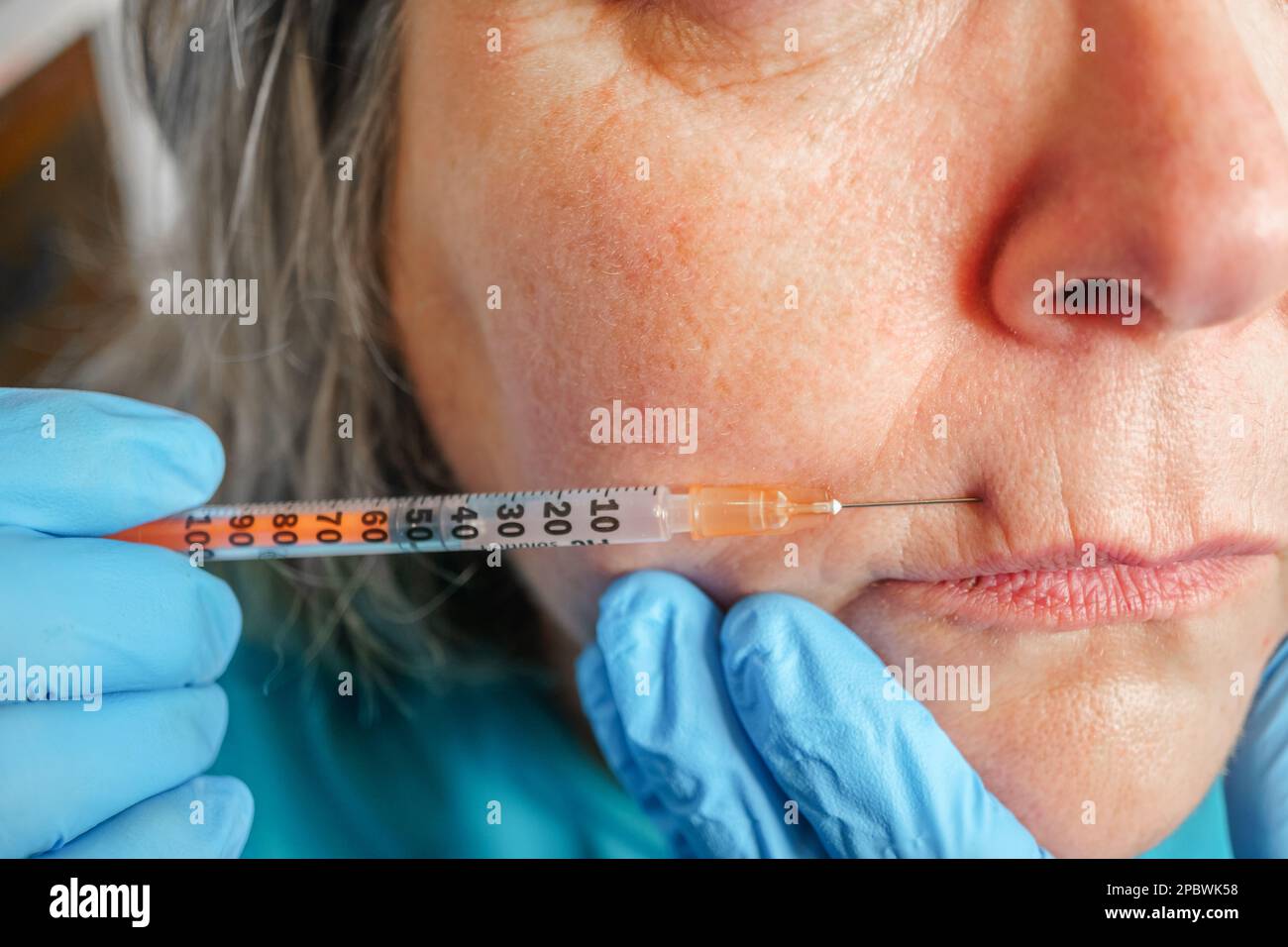 Seniorin bekommt Injektionen in die Lippen. Plastisch-chirurgische Klinik. Stockfoto