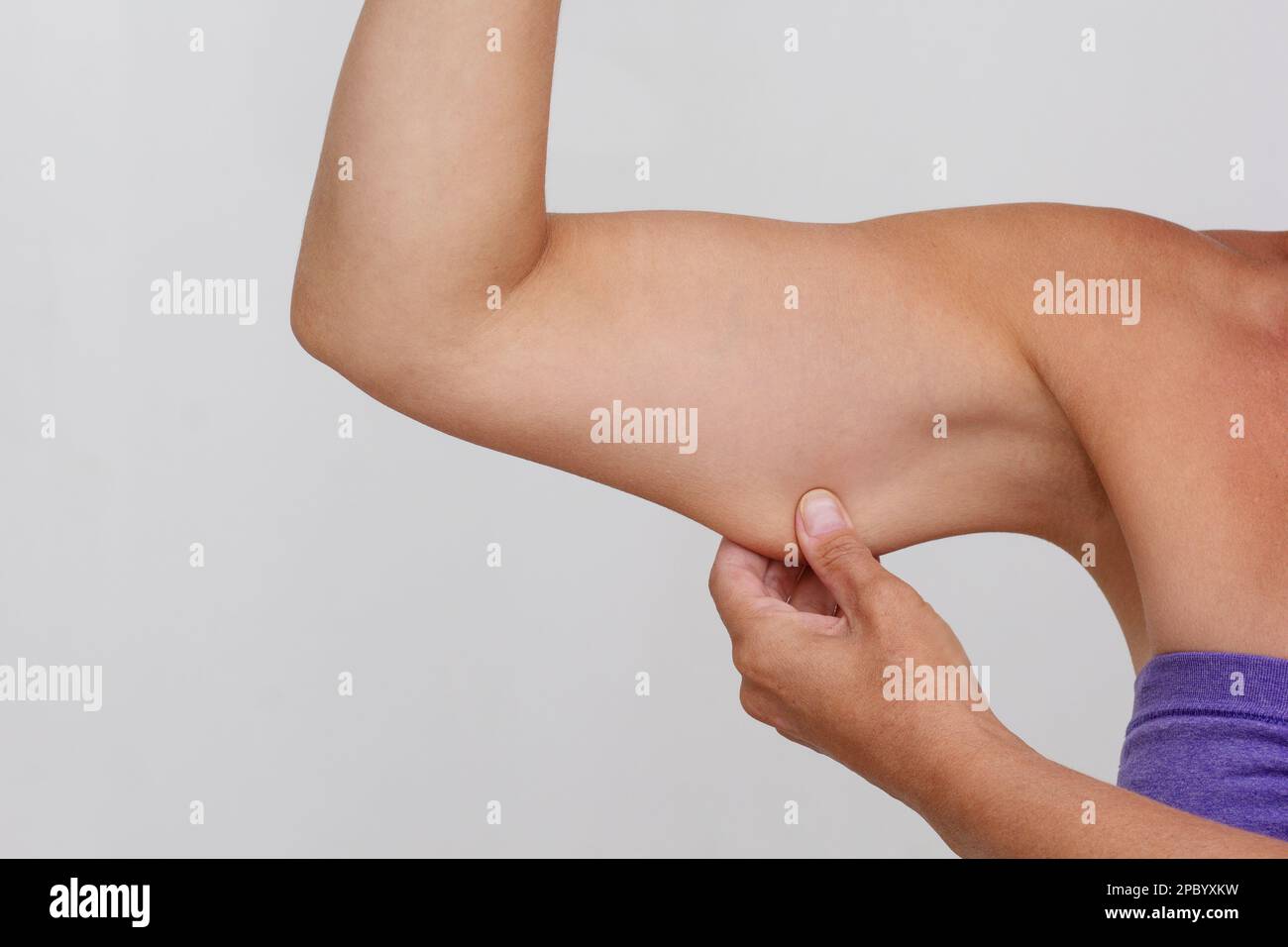 Verkürzter Frauenkörper mit Arm und hängender Haut auf grauem Hintergrund Stockfoto