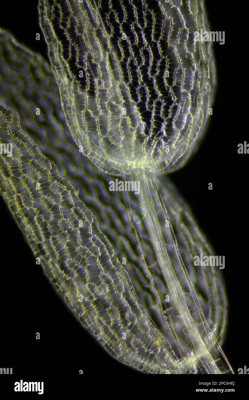 Mikroskopische Darstellung des Torfmoos (Sphagnum). Dunkelfeldbeleuchtung. Stockfoto