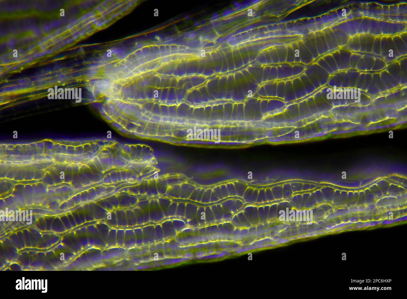 Mikroskopische Betrachtung von Torfmoosblättern (Sphagnum). Dunkelfeldbeleuchtung. Stockfoto
