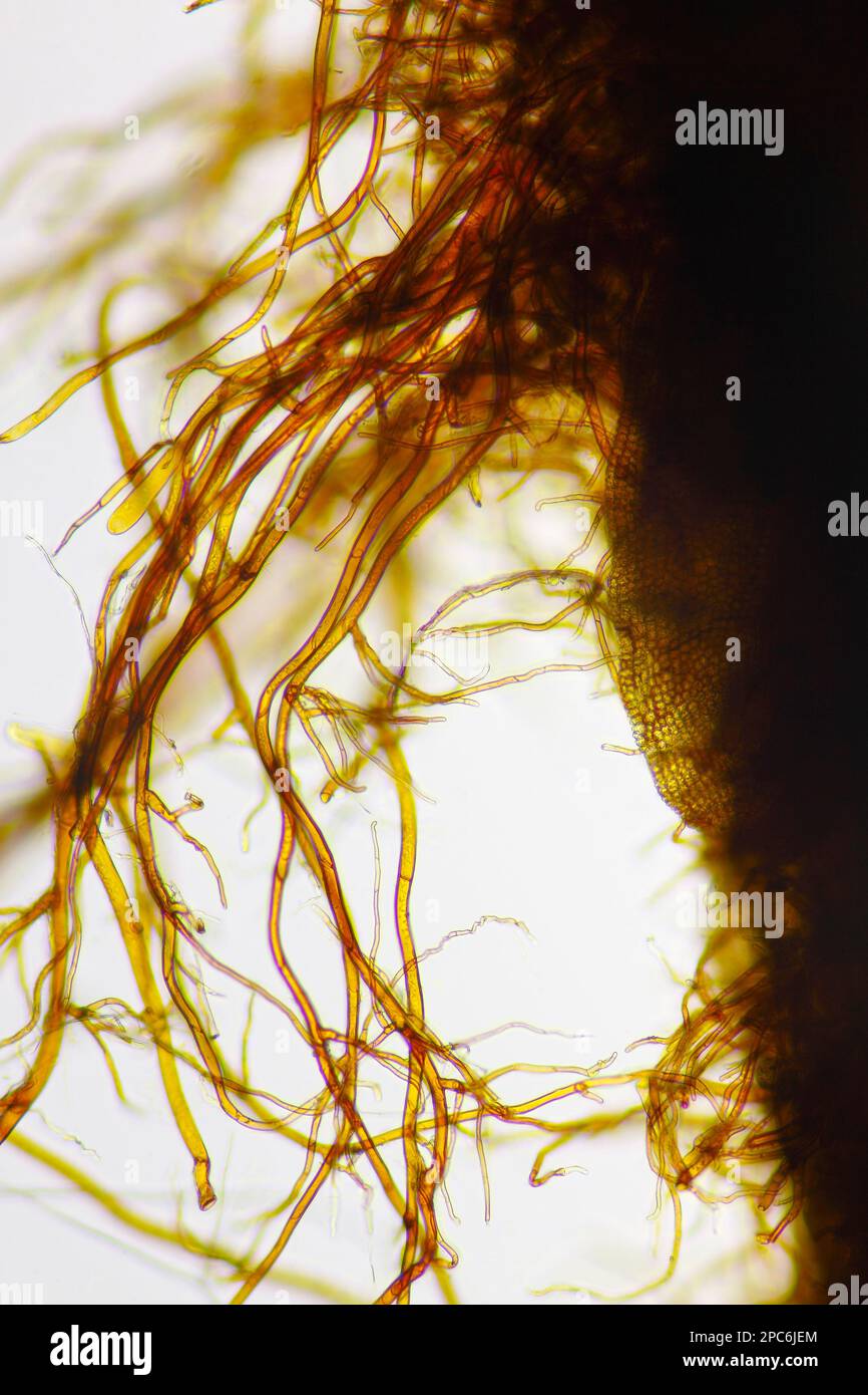 Mikroskopische Betrachtung von Moosrhizoiden. Hellfeldbeleuchtung. Stockfoto