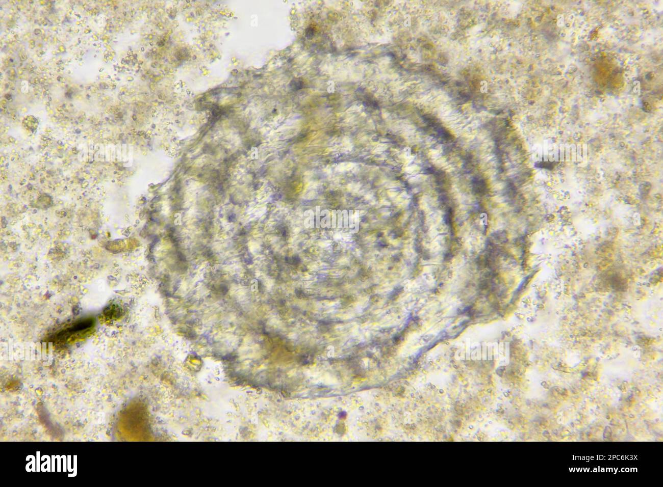 Mikroskopische Betrachtung unspezifizierter mariner Mikrofossile aus silurischem Kalkstein. Hellfeldbeleuchtung. Stockfoto